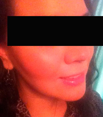 Trauma Facial