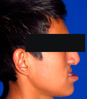 Trauma Facial