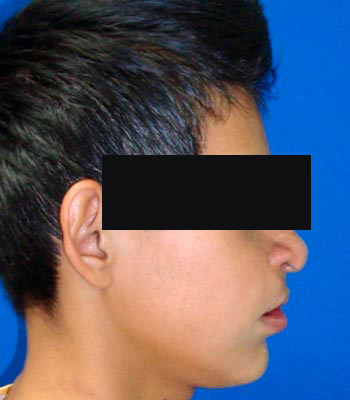 Trauma Facial