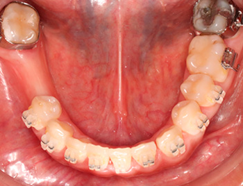 Trauma Facial