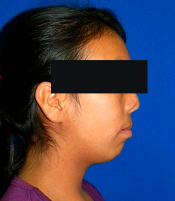 Trauma Facial