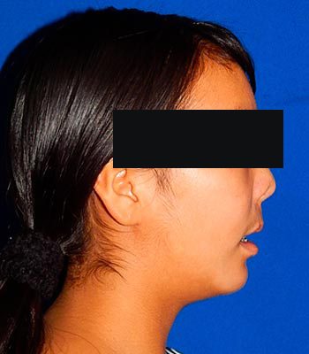 Trauma Facial