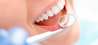 ¿Cuánto cuestan los implantes dentales?