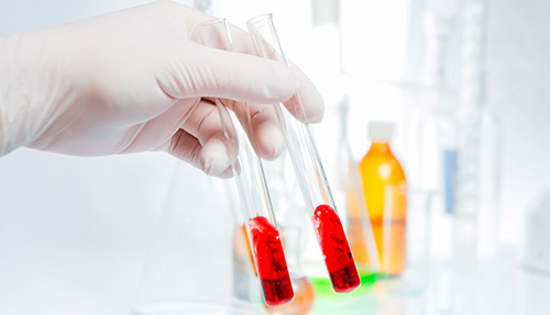Plasma rico en factores del crecimiento