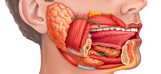 Tumor de glándulas salivales